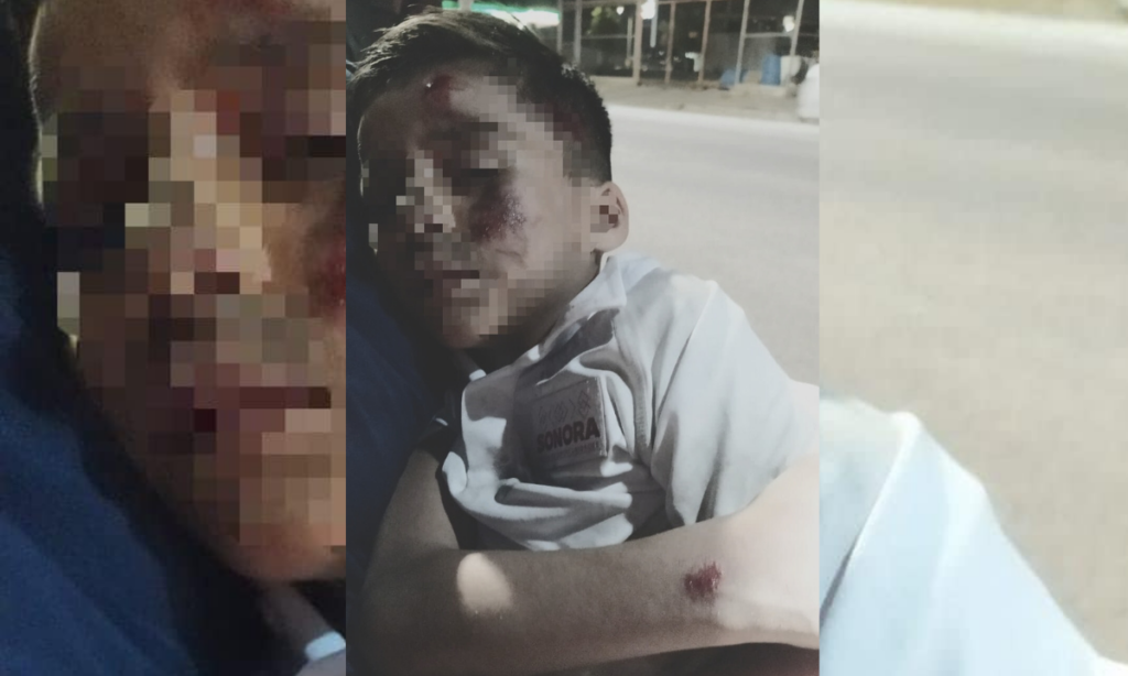 Atropellan a niño de 6 años y conductor se da a la fuga al norte de Hermosillo