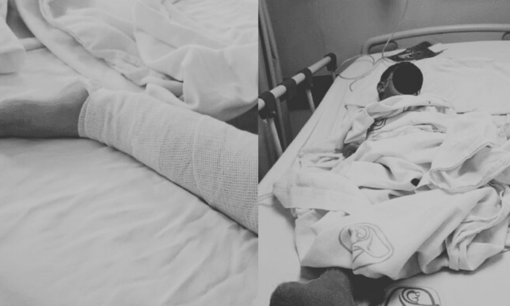 ¡Ayudemos a Alexander! Niño de 4 años atropellado en Nogales necesita apoyo urgente