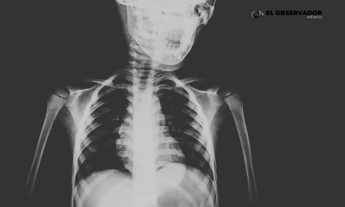 ¡No es el cáncer! Esta es la verdadera causa principal de muerte en el mundo