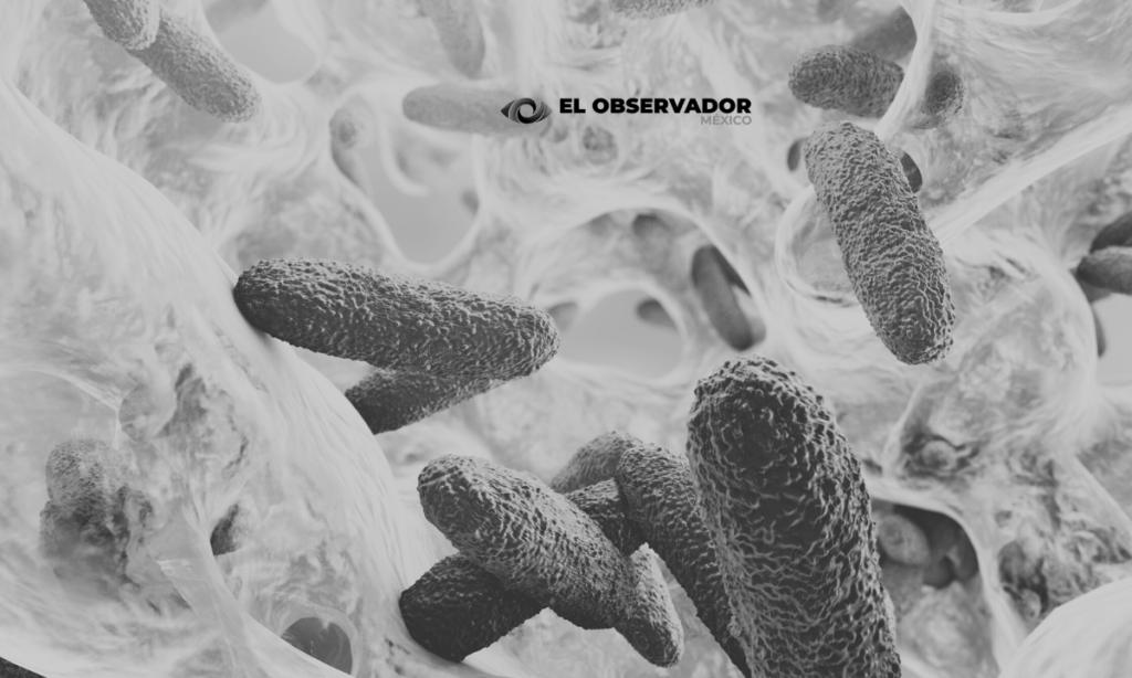 Klebsiella oxytoca