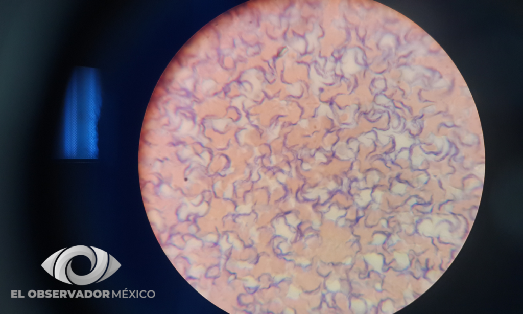 mal de Chagas