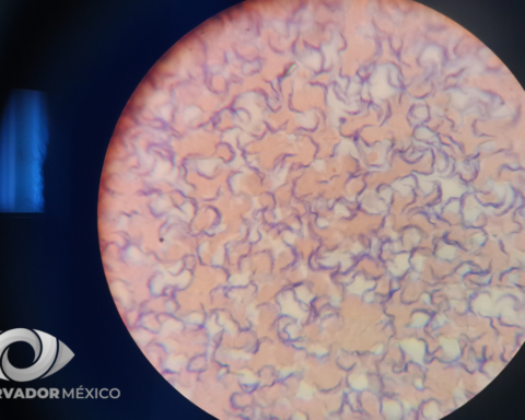 mal de Chagas